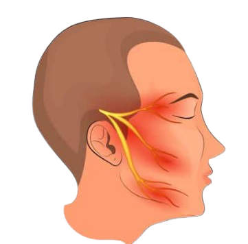 Neuralgia do Trigêmio