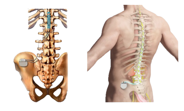 dor - coluna - neurocirurgia