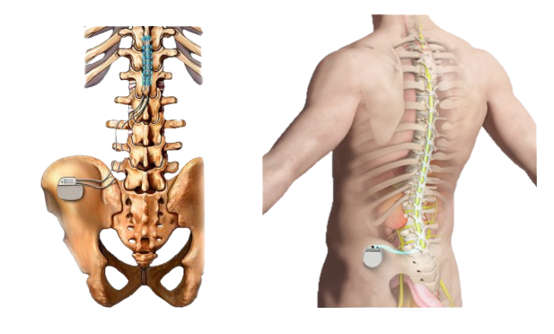 dor - coluna - neurocirurgia