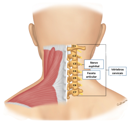 dor cervical