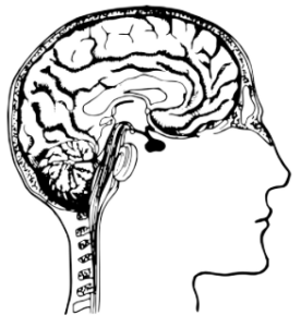 tumor cerebral