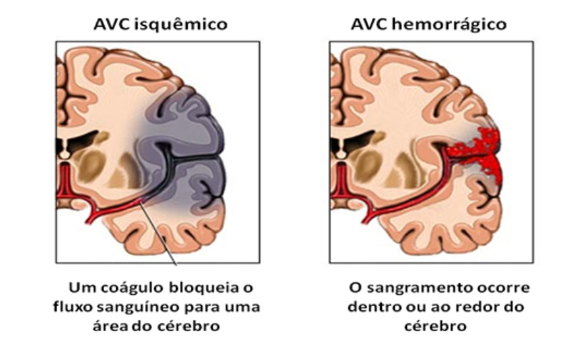 tipos de ave