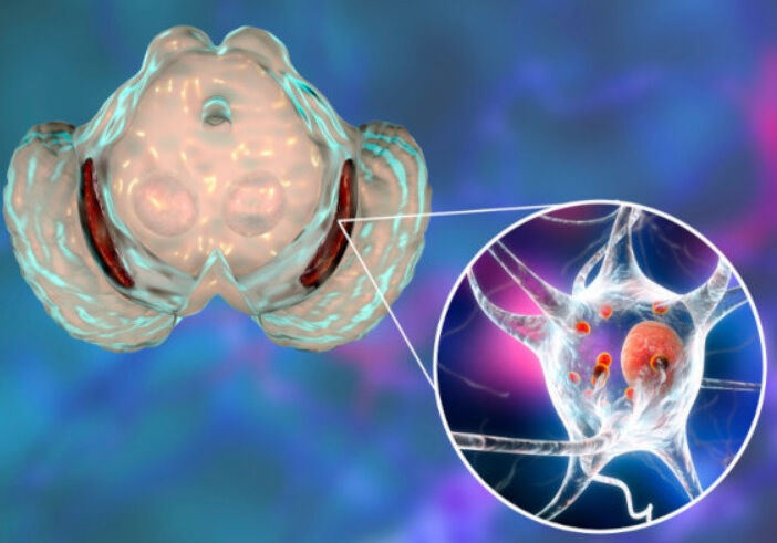 Causas da doença de Parkinson